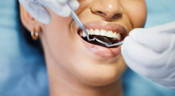 Best Emergency Wisdom Tooth Extraction in Alamo, TN
